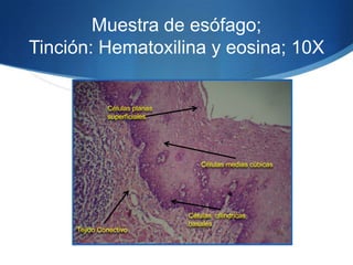 Muestra de esófago; Tinción: Hematoxilina y eosina; 10X Células planas superficialesCélulas medias cúbicasCélulas  cilíndricas basalesTejido Conectivo