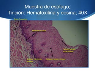 Muestra de esófago; Tinción: Hematoxilina y eosina; 40X Tejido ConectivoMembrana basalCélulas planas superficialesCélulas medias cúbicasCélulas  cilíndricas basales