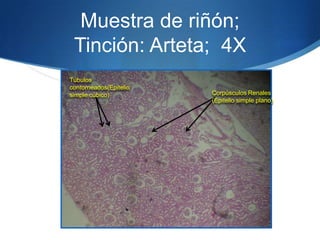 Muestra de riñón; Tinción: Arteta;  4X Túbulos contorneados(Epitelio simple cúbico)Corpúsculos Renales (Epitelio simple plano)