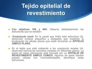 Tejido epitelial de revestimientoCon objetivos 10X y 40X: Observe detalladamente las estructuras que se señalan:-Corpúsculo renal: En la pared que limita esta estructura Ud. observará núcleos pequeños y alargados que muestran la localización de células planas que están formando un EPITELIO SIMPLE PLANO.En el tejido que está rodeando a los corpúsculo renales Ud. observará estructuras tubulares cortadas en diferentes planos. La  pared de estas estructuras está formada por un EPITELIO DE REVESTIMIENTO SIMPLE CUBICO. Algunos de estos túbulos poseen células con microvellosidades, identifique estas estructuras.