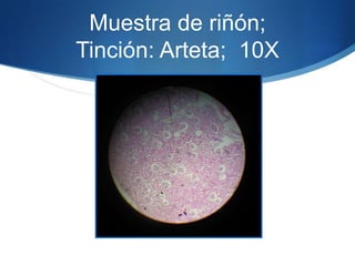 Muestra de riñón; Tinción: Arteta;  10X 