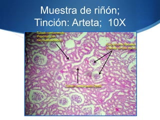 Muestra de riñón; Tinción: Arteta;  10X Túbulo contorneado Proximal (con microvellosidades)Corpúsculos Renales (Epitelio simple plano)Túbulo contorneado Distal
