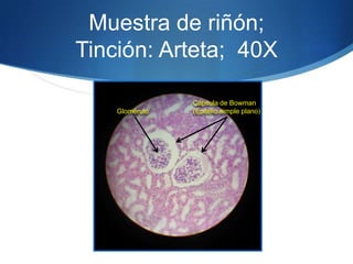 Muestra de riñón; Tinción: Arteta;  40X Cápsula de Bowman (Epitelio simple plano)Glomérulo