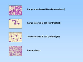 Histologia linfoide | PDF