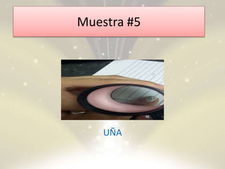 Muestra #5
UÑA
 