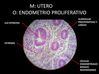 M: UTERO
O: ENDOMETRIO PROLIFERATIVO
GLÁNDULAS
PROLIFERATIVAS Y
LARGAS
CÉLULAS
ENDOMETRIALES
BASALES
REGENERANDO
LUZ ESTRECHA
ESTROMA
 