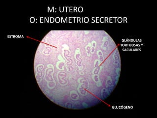 M: UTERO
O: ENDOMETRIO SECRETOR
GLÁNDULAS
TORTUOSAS Y
SACULARES
GLUCÓGENO
ESTROMA
 