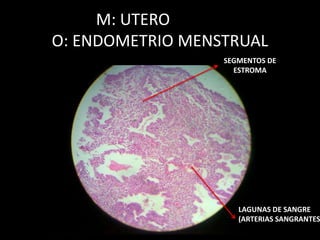 M: UTERO
O: ENDOMETRIO MENSTRUAL
SEGMENTOS DE
ESTROMA
LAGUNAS DE SANGRE
(ARTERIAS SANGRANTES
 