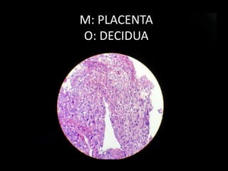 M: PLACENTA
O: DECIDUA
 