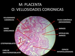 M: PLACENTA
O: VELLOSIDADES CORIONICAS
PLACA CORIÓNICA
(MESODERMO)
VELLOSIDADES
CARIÓNICAS
CAPA DE
SINCITIOTROFOBLASTO
ESPACIO
INTERVELLOSIDADES
AMNIOS
EPITELIO DEL
AMNIOS
VASOS
SANGUINEOS
CITOTROFOBLASTO
 