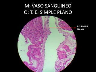 M: VASO SANGUINEO
O: T. E. SIMPLE PLANO
T.E. SIMPLE
PLANO
 