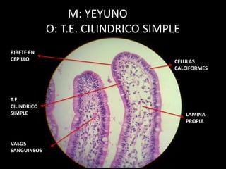 M: YEYUNO
O: T.E. CILINDRICO SIMPLE
CELULAS
CALCIFORMES
RIBETE EN
CEPILLO
T.E.
CILINDRICO
SIMPLE LAMINA
PROPIA
VASOS
SANGUINEOS
 