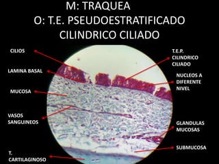 M: TRAQUEA
O: T.E. PSEUDOESTRATIFICADO
CILINDRICO CILIADO
CILIOS T.E.P.
CILINDRICO
CILIADO
GLANDULAS
MUCOSAS
VASOS
SANGUINEOS
NUCLEOS A
DIFERENTE
NIVEL
LAMINA BASAL
MUCOSA
SUBMUCOSA
T.
CARTILAGINOSO
 