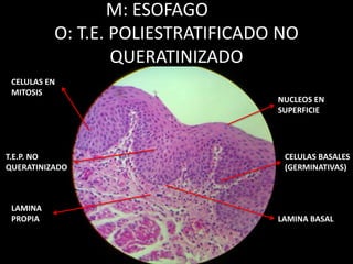 M: ESOFAGO
O: T.E. POLIESTRATIFICADO NO
QUERATINIZADO
CELULAS EN
MITOSIS
CELULAS BASALES
(GERMINATIVAS)
NUCLEOS EN
SUPERFICIE
LAMINA
PROPIA
T.E.P. NO
QUERATINIZADO
LAMINA BASAL
 