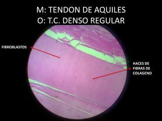 M: TENDON DE AQUILES
O: T.C. DENSO REGULAR
HACES DE
FIBRAS DE
COLAGENO
FIBROBLASTOS
 