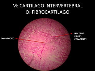 M: CARTILAGO INTERVERTEBRAL
O: FIBROCARTILAGO
HACES DE
FIBRAS
COLAGENASCONDROCITO
 