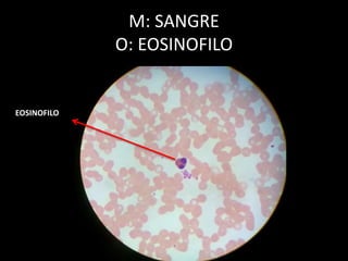 M: SANGRE
O: EOSINOFILO
EOSINOFILO
 