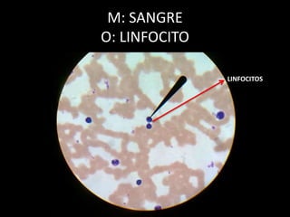 M: SANGRE
O: LINFOCITO
LINFOCITOS
 