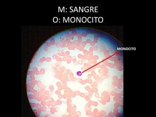 M: SANGRE
O: MONOCITO
MONOCITO
 