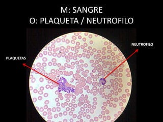 M: SANGRE
O: PLAQUETA / NEUTROFILO
NEUTROFILO
PLAQUETAS
 