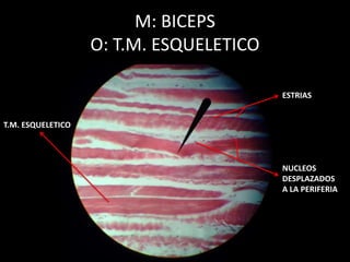 M: BICEPS
O: T.M. ESQUELETICO
ESTRIAS
NUCLEOS
DESPLAZADOS
A LA PERIFERIA
T.M. ESQUELETICO
 