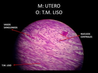 M: UTERO
O: T.M. LISO
T.M. LISO
NUCLEOS
CENTRALES
VASOS
SANGUINEOS
 
