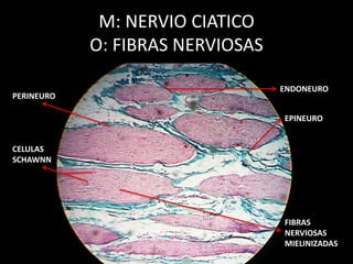 M: NERVIO CIATICO
O: FIBRAS NERVIOSAS
EPINEURO
PERINEURO
ENDONEURO
CELULAS
SCHAWNN
FIBRAS
NERVIOSAS
MIELINIZADAS
 
