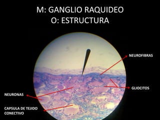M: GANGLIO RAQUIDEO
O: ESTRUCTURA
NEUROFIBRAS
GLIOCITOS
NEURONAS
CAPSULA DE TEJIDO
CONECTIVO
 
