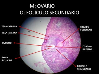 M: OVARIO
O: FOLICULO SECUNDARIO
LIQUIDO
FOLICULAR
OVOCITO
ZONA
PELUCIDA
CORONA
RADIADA
TECA INTERNA
TECA EXTERNA
FOLICULO
SECUNDARIO
 