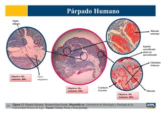 Párpado Humano
24
Músculo
orbicular
Glándulas
Sebáceas
Conducto
Excretor
Tejido
adiposo
Vasos
sanguíneos
Epitelio
estratificado
plano no
queratinizado
Músculo
Objetivo: 10x
Aumento: 100x
Objetivo: 40x
Aumento: 400x
Objetivo: 40x
Aumento: 400x
Figura 23. Párpado Humano. Hematoxilina-Eosina. Disponible en: Laboratorio de Histología y Patología de la
Universidad Técnica de Loja. Fuente: Stefany Poma y Irina Quizhpe
 