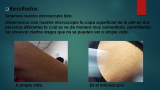  Resultados:
Tenemos nuestro microscopio listo
Observamos con nuestro microscopio la capa superficial de la piel en dos
personas diferentes la cual se ve de manera muy aumentada, permitiendo
así observar ciertos rasgos que no se pueden ver a simple vista.
A simple vista En el microscopio
 