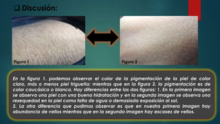 En la figura 1. podemos observar el color de la pigmentación de la piel de color
claro, más o menos piel trigueña; mientras que en la figura 2. la pigmentación es de
color caucásica o blanca. Hay diferencias entre las dos figuras: 1. En la primera imagen
se observa una piel con una buena hidratación y en la segunda imagen se observa una
resequedad en la piel como falta de agua o demasiada exposición al sol.
2. La otra diferencia que pudimos observar es que en nuestra primera imagen hay
abundancia de vellos mientras que en la segunda imagen hay escasez de vellos.
Figura 1 Figura 2
 Discusión:
 