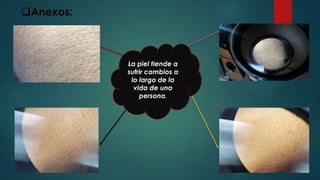La piel tiende a
sufrir cambios a
lo largo de la
vida de una
persona.
Anexos:
 