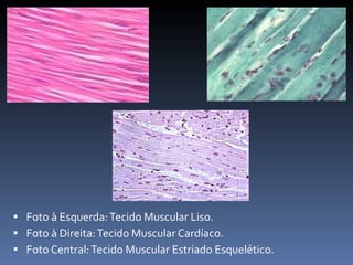 Foto à Esquerda: Tecido Muscular Liso. Foto à Direita: Tecido Muscular Cardíaco. Foto Central: Tecido Muscular Estriado Esquelético. 