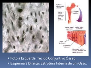 Foto à Esquerda: Tecido Conjuntivo Ósseo. Esquema à Direita: Estrutura Interna de um Osso. 