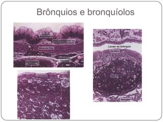 Brônquios e bronquíolos 