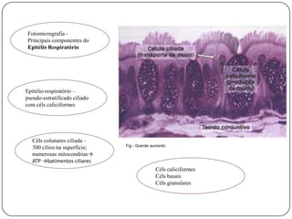 Fotomicrografia - Principais componentes do Epitélio RespiratórioEpitélio respiratório – pseudo-estratificado ciliado com céls caliciformesCélscolunares ciliada – 300 cílios na superfície; numerosas mitocondrias-> ATP->batimentos ciliaresFig - Grande aumentoCéls caliciformes Céls basais Céls granulares