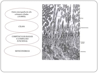 Eletro-micrografia de célscolunares ciliadas (10.000X)CÍLIOSCORPÚSCULOS BASAIS E COMPLEXO JUNCIONALMITOCONDRIAS