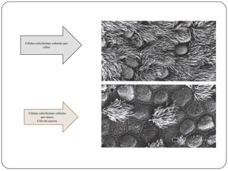 Células caliciformes cobertas por cílios Células caliciformes cobertas por muco;Céls em escova.