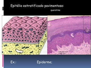 Epitélio estratificado pavimentoso:
queratina
Ex.: Epiderme;
 