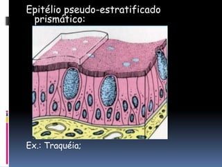 Epitélio pseudo-estratificado
prismático:
Ex.: Traquéia;
 