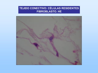 TEJIDO CONECTIVO: CÉLULAS RESIDENTES
          FIBROBLASTO. HE
 