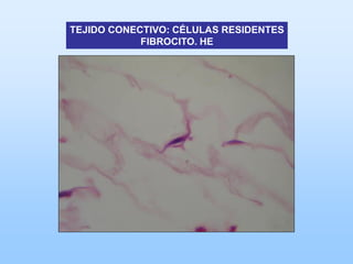 TEJIDO CONECTIVO: CÉLULAS RESIDENTES
            FIBROCITO. HE
 
