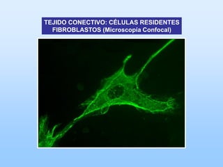 TEJIDO CONECTIVO: CÉLULAS RESIDENTES
  FIBROBLASTOS (Microscopía Confocal)
 