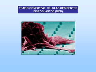 TEJIDO CONECTIVO: CÉLULAS RESIDENTES
         FIBROBLASTOS (MEB)
 