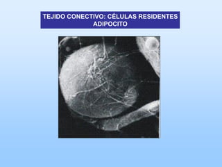TEJIDO CONECTIVO: CÉLULAS RESIDENTES
             ADIPOCITO
 