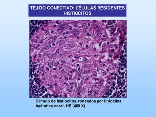 TEJIDO CONECTIVO: CÉLULAS RESIDENTES
            HISTIOCITOS




 Cúmulo de histiocitos, rodeados por linfocitos.
 Apéndice cecal. HE (400 X)
 