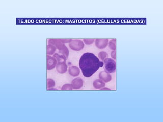 TEJIDO CONECTIVO: MASTOCITOS (CÉLULAS CEBADAS)
 