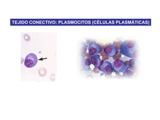 TEJIDO CONECTIVO: PLASMOCITOS (CÉLULAS PLASMÁTICAS)
 