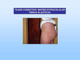 TEJIDO CONECTIVO: MATRIZ EXTRACELULAR
           FIBRAS ELÁSTICAS
 